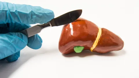 แพทย์ชี้ ชายไทยเป็น “มะเร็งตับ” มากที่สุด ผู้ป่วยใหม่ผุด 2 หมื่นรายต่อปี