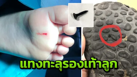 พ่อโวยสนามบินให้จ่ายค่าทำแผล หลังลูก 3 ขวบ ถูกสกรูเกลียวปล่อยตำเท้าเลือดอาบ