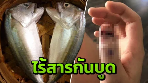 อ.เจษฎา แจง ปลาทูนึ่งใส่สารกันบูดทำแม่ค้าเป็นมะเร็งที่นิ้ว ไม่ใช่เรื่องจริง
