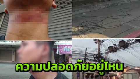 เจ็บตัวฟรี? หนุ่มอดีตทหารเกณฑ์โดนสายเคเบิลเกี่ยวคอ จยย.คว่ำระทึก