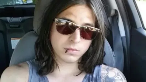 ช็อก หนุ่มหล่อมะกัน เจอบุหรี่ไฟฟ้าระเบิด ชิ้นส่วนบาดเหวอะ ทะลุคอ ดับสลด