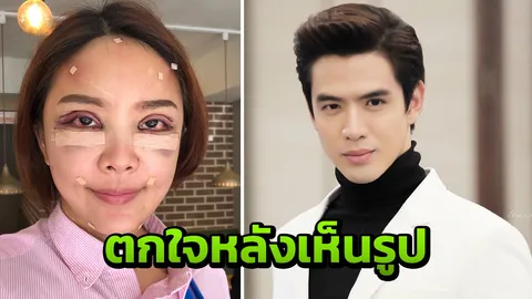 ฟิล์ม ธนภัทร ถึงกับตกใจหลังเห็นแผลบนหน้า หญิงแย้ หลังอัพหน้าใหม่