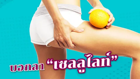 "เซลลูไลท์" ปัญหาผู้หญิง เคล็ดลับบอกลา "ผิวเปลือกส้ม" โชว์เรียวขาสวยงาม