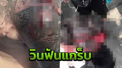 วินมอเตอร์ไซค์ ฟันฉับที่ไหล่ หนุ่มขับแกร็บไบค์ แผลเหวอะสุดสยอง