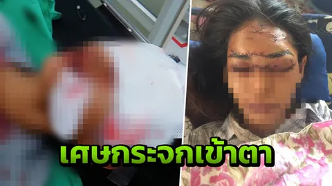 สาวหวิดตาบอด หน้าเบี้ยว น้องโวย อ้าง รพ.ชุ่ย ล้างแผล-ให้กลับบ้าน