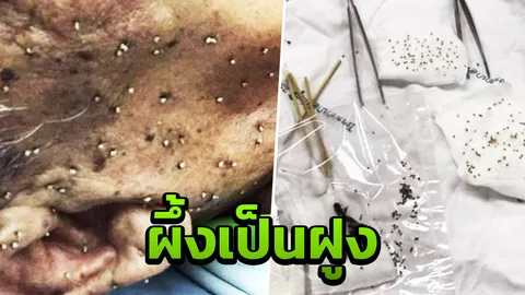 ต้องระวัง พบคุณตา ถูกฝูงผึ้งนับร้อยรุมต่อย เหล็กในฝังเต็มหน้า