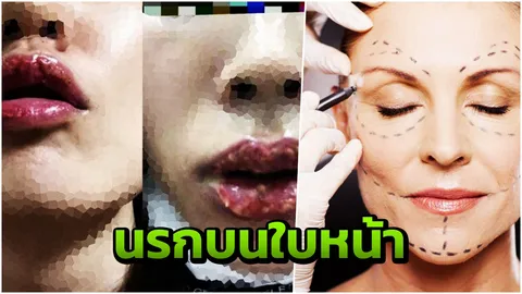 อาชญากรศัลยกรรมความงาม จาก "สวรรค์" กลายเป็น "นรก" ต้องรู้เท่าทันเกม