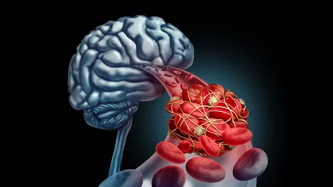 นักวิทยาศาสตร์เปลี่ยนสัญญาณสมองเป็นคำพูด