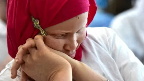 ประหารหนุ่มมาลาวี ฆ่าคนเผือก เชื่อหมอยาบอกทำแล้วจะรวย