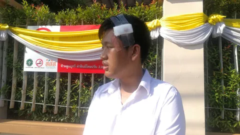 หนุ่ม เล่นโทรศัพท์เพลิน ถูกเก้าอี้ฟาดหัว มีดแทง ชิงทรัพย์กลางหาดใหญ่