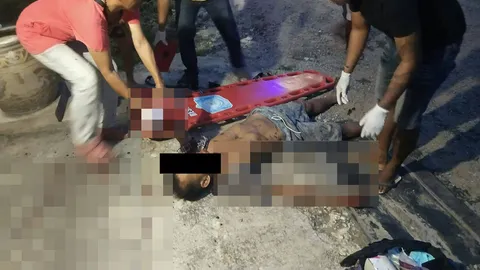 ลุงเจอระเบิดลูกบอลหน้าบ้าน พลาดแกะบึมสนั่นมือเละ ร้องโอดโอยเจ็บปวด 