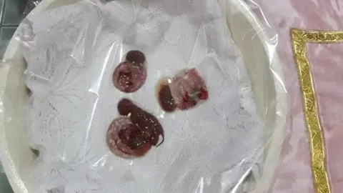 สุดแปลก แม่เหมียว เคาะประตูเรียก ก่อนตกลูก3ตัว เป็น"ลูกกรอก" 