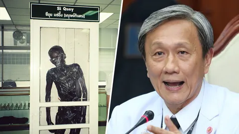 “หมอประสิทธิ์” ย้ำยกร่างซีอุยเป็นอาจารย์ใหญ่