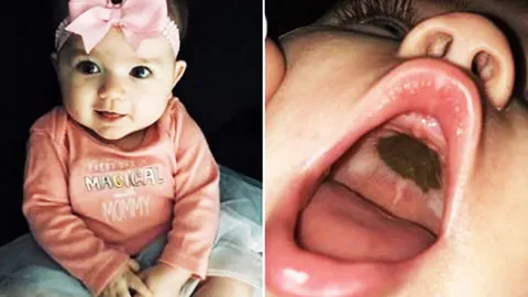 อะไรในปากลูกน้อย