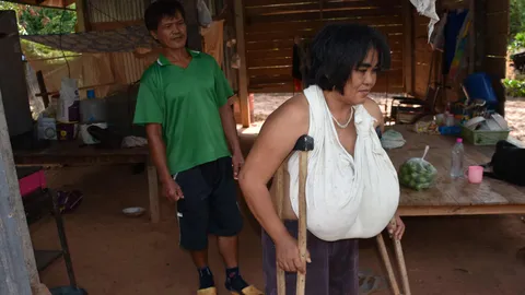 สาวใหญ่ทุกข์หนัก ป่วย"นมโต"ไม่ทราบสาเหตุ ใช้ชีวิตสุดลำบาก 
