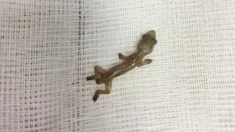 หมอช็อก คนไข้หูอื้อมา 2 วัน ส่องเจอ "จิ้งจก" ตัวใหญ่ ดิ้นอยู่ในรูหู