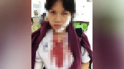 ญาติอ้างหลานสาวโดนแกล้ง กระจกบาดหน้า คู่กรณีจ่าย 5 พันขอให้เรื่องจบ