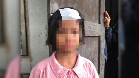 แม่พาลูกวัย 12 แจ้งตร.ถูกครูตีหัวแตกบอกทำโทษได้ไม่ว่า แต่ขั้นเย็บก็ไม่ไหว