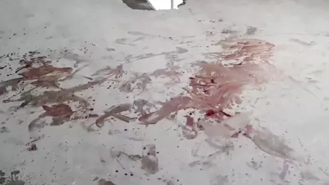 สองหนุ่มคนงาน ชักมีดแทงกันสาหัส ปมรุ่นน้องพูดหยามเมียรุ่นพี่ไม่สวย