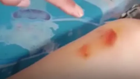 เตือนภัย มิจฉาชีพอ้างเป็นหมอจีน จับจุดวินิจฉัยโรค หลอกเงินคนแก่เกือบหมื่น