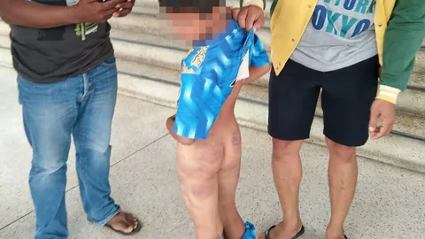 เหยื่อครูดุ