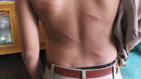 รุมจวก "ครู" เตะ-ถีบ เด็กป.6 แถมดุด่า แม่เหลืออดโพสต์ประจาน แจ้งความ