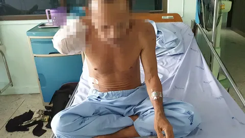 ร็อตไวเลอร์ขย้ำ ลูกจ้างกะเหรี่ยง สลบคาคมเขี้ยว แขนเหวอะต้องตัดทิ้ง