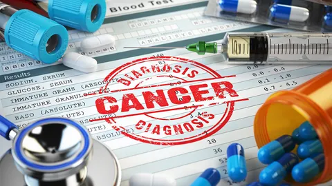 ใช้ภาพเอกซเรย์คลื่นแม่เหล็กตัดชิ้นเนื้อ ลดเสี่ยง "มะเร็งต่อมลูกหมาก"