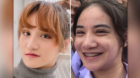 "ครีม ชลิตา" ร้องซื้อคอร์สคลินิกดัง ได้ครีม 7 หลอด สิวเห่อเต็มหน้า