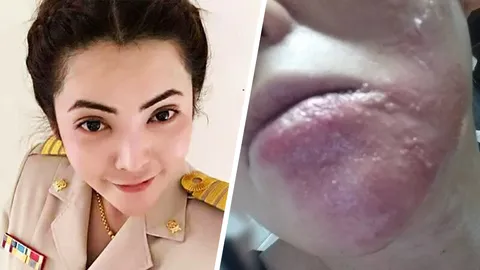 ครูวา โต้แหลก ไม่เคยหลอกใคร ทุกคนให้เพราะเสน่หา ยันป่วย งูสวัด