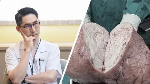 หมอเตือน "เนื้องอกกล้ามเนื้อมดลูก" รู้ทันรับมือไว แนะสาวตรวจภายในทุกปี (คลิป)