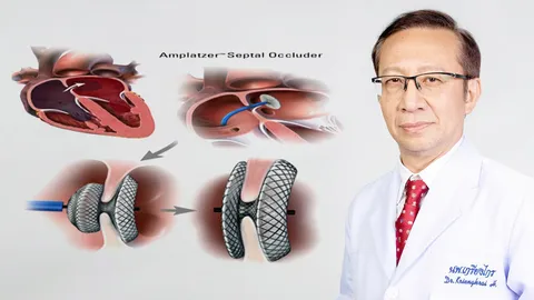 สกู๊ปหน้า 1 : ผนังกั้นหัวใจห้องบนรั่ว โรคนี้น่ากลัวแต่รักษาได้