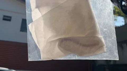 หนุ่มไอกลางดึก สยองเจอพยาธิ ยาว 6 นิ้ว ในลำคอ