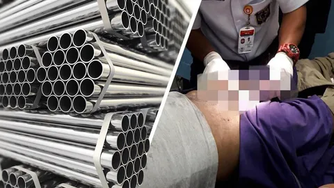 สำเร็จความใคร่ผิดที่ หนุ่มวัย 21 อวัยวะเพศติดท่อ 5 วัน เน่าต้องตัดทิ้ง