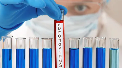 สมาร์ทไลฟ์ : ปฏิบัติการตรวจหา "โคโรนา ไวรัส 2019" รู้ผลภายใน 3 ชั่วโมง