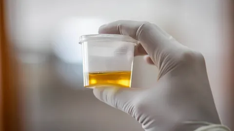 เปิดม่าน joke opera : ฉี่เป็นแอลกอฮอล์