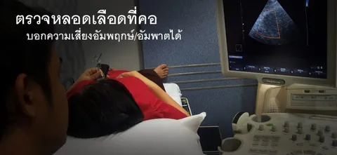 ตรวจหลอดเลือดที่คอ บอกความเสี่ยงอัมพฤกษ์/อัมพาตได้