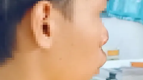 เต้นยียวนเหมือนหาเรื่อง 2 หนุ่มเตะก้านคอวัยรุ่นวัย 17 สลบ หน้าเวทีหมอลำ 