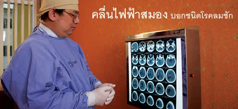 คลื่นไฟฟ้าสมอง บอกชนิดโรคลมชัก 