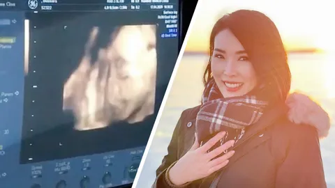 เข้าใจผิดรีบเคลียร์หลัง กิ้น แฟนเก่า โอ๊ต ปราโมทย์  เผยภาพอัลตราซาวนด์ 