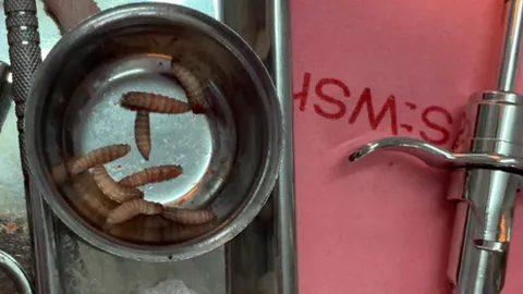 ช็อก! หนอนตัวเป็นๆ ทำรังในปากคนไข้ติดเตียง หมอผ่าเจอ 12 ตัว