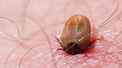 เตือนโดน “เห็บ” กัดให้รีบคีบออกทันที