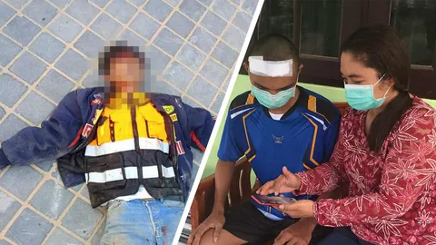 แม่โพสต์ คนเถื่อนทำร้ายลูก 7 รุม 1 โดยไม่รู้จักมาก่อน เจ็บหนักต้องผ่าสมอง