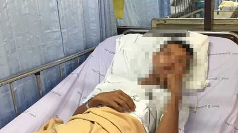 โจ๋พม่าคาบปลาหมอ จับได้ดันเอาปากกัด ดิ้นหลุดเข้าคอระทึก (คลิป)