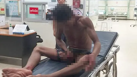 หนุ่มคลั่ง เฉือนเจ้าโลกเลือดสาด นอนร้องครวญคราง อ้างมีพยาธิอยู่ข้างใน