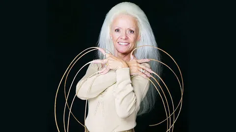 สุดอาลัยอดีตเล็บงาม