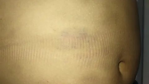 ยายสุดช้ำ แจ้งตร. จับลูกสาวและแฟน หลังหลานชายวัย 6 ขวบถูกทำร้าย 