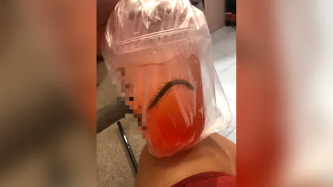 แม่เตือนภัย ลูกชายวัย 4 ขวบ กำลังจะดูดน้ำ ตกใจเจอตะขาบซุกในหลอด