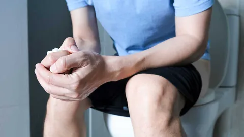 รู้จักโรคบริเวณทวารหนัก : ริดสีดวงทวาร (ตอน 2)