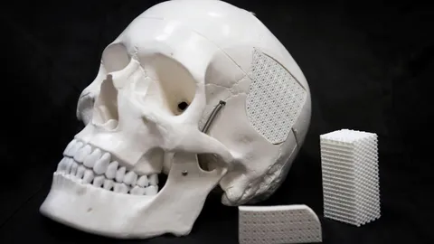 สร้างวัสดุผสมจากเปลือกไข่ช่วยการบาดเจ็บ